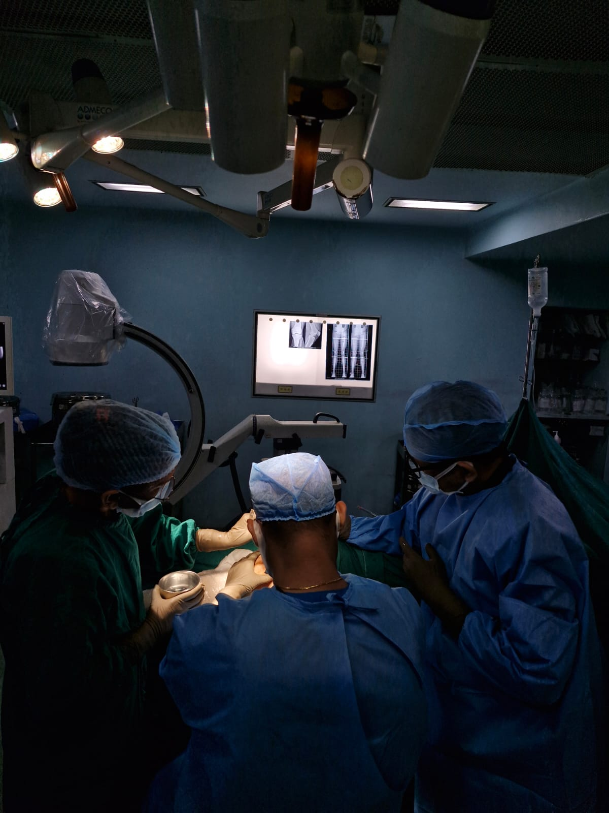 Ultrasound
