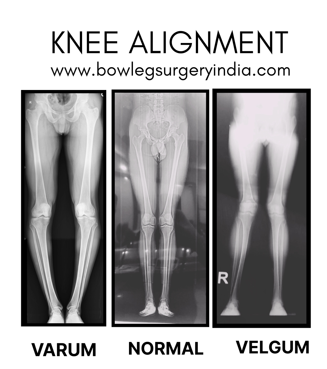 Treatment Image