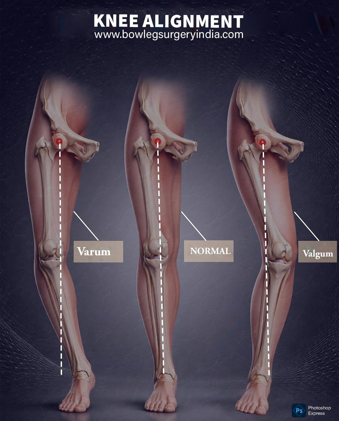 Treatment Image